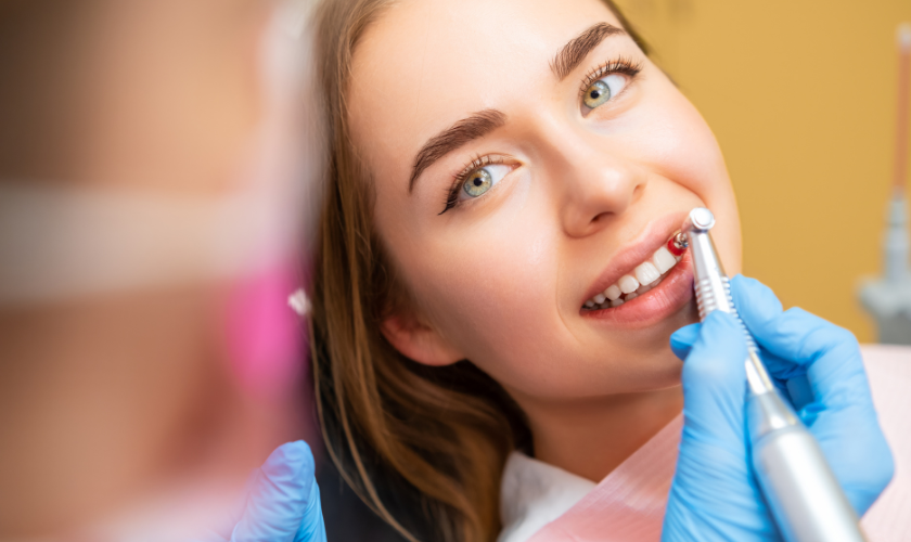 Finding the Right Dentist for Enamel Removal