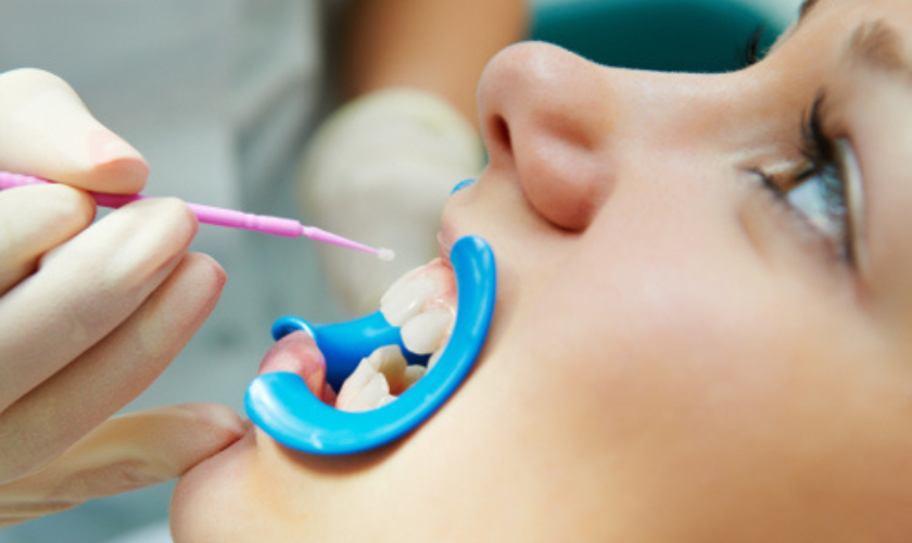 The Process of Applying Sealants