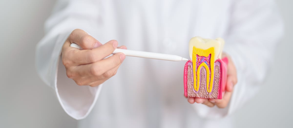 Root Canal Treatment in Charlotte